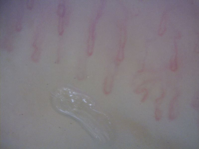 MEDL4N5 Dino-Lite CapillaryScope 500 Pro Digital Mikroskop