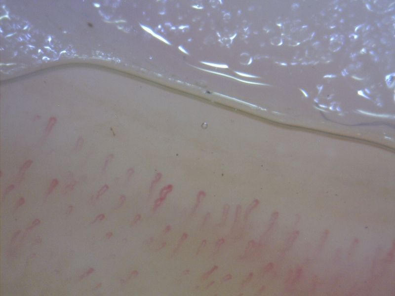 MEDL4N5 Dino-Lite CapillaryScope 500 Pro Digital Mikroskop