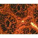 SOIF BK-FL2 Model Trinoküler Flerosan Ataçmanlı Araştırma Mikroskobu