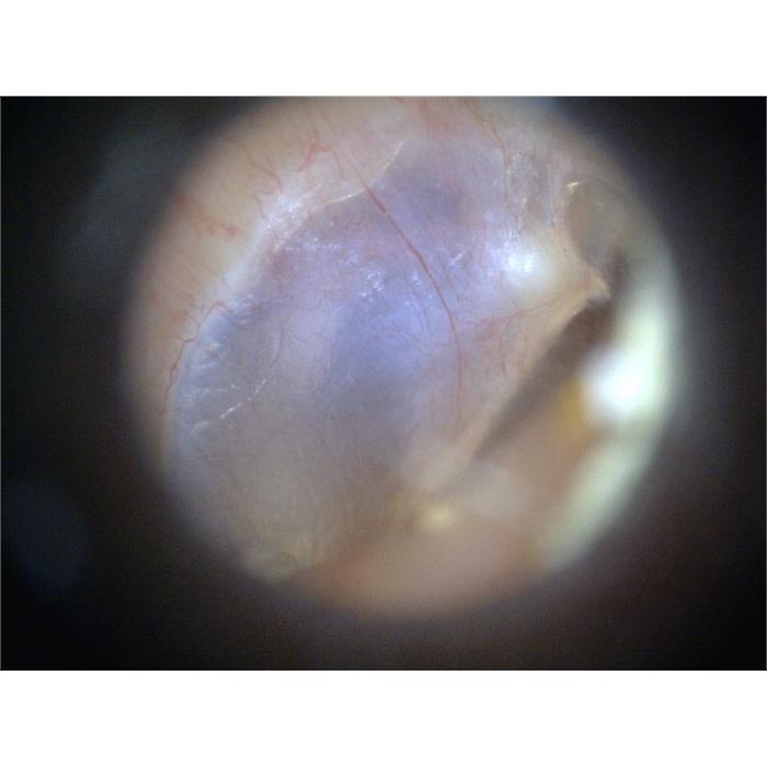 MEDL3E Dino-Lite EarScope Basic Digital Mikroskop