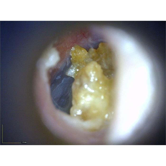 MEDL3E Dino-Lite EarScope Basic Digital Mikroskop