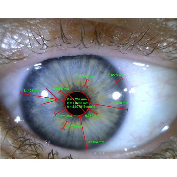 MEDL4R Dino-lite IriScope Digital Mikroskop