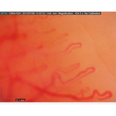 MEDLW4N5 PRO Dino-Lite CapillaryScope 500 Pro Wireless